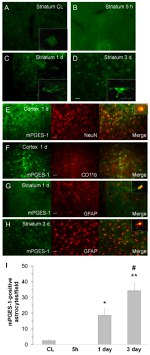 GFAP Antibody in Immunohistochemistry (IHC)