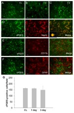 GFAP Antibody in Immunohistochemistry (IHC)