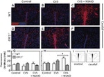 GFAP Antibody in Immunohistochemistry (IHC)