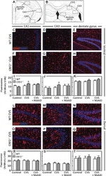 GFAP Antibody in Immunohistochemistry (IHC)