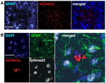 GFAP Antibody in Immunocytochemistry (ICC/IF)
