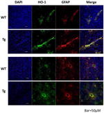 GFAP Antibody in Immunohistochemistry (IHC)