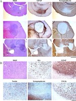 GFAP Antibody in Immunohistochemistry (IHC)