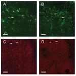 GFAP Antibody in Immunohistochemistry (IHC)