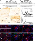GFAP Antibody in Immunohistochemistry (IHC)