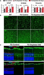 GFAP Antibody in Immunohistochemistry (IHC)