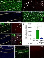 GFAP Antibody in Immunohistochemistry (Paraffin) (IHC (P))
