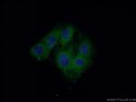 SACM1L Antibody in Immunocytochemistry (ICC/IF)