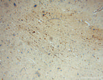 SACM1L Antibody in Immunohistochemistry (Paraffin) (IHC (P))