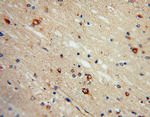 SACM1L Antibody in Immunohistochemistry (Paraffin) (IHC (P))