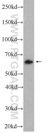 SACM1L Antibody in Western Blot (WB)