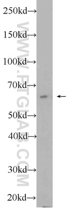 SACM1L Antibody in Western Blot (WB)