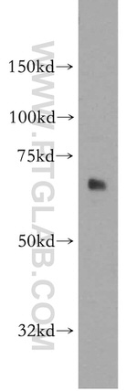 SACM1L Antibody in Western Blot (WB)