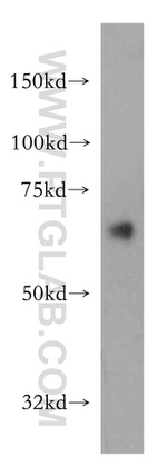 SACM1L Antibody in Western Blot (WB)