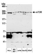 mTOR Antibody in Western Blot (WB)