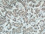 RAD9A Antibody in Immunohistochemistry (Paraffin) (IHC (P))