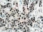RAD9A Antibody in Immunohistochemistry (Paraffin) (IHC (P))