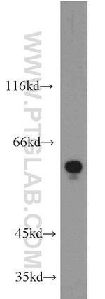 RAD9A Antibody in Western Blot (WB)