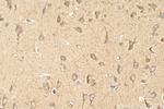 TSPAN3 Antibody in Immunohistochemistry (Paraffin) (IHC (P))