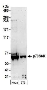 p70S6K Kinase Antibody in Western Blot (WB)