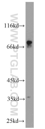 CACNB1 Antibody in Western Blot (WB)