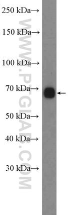 CACNB1 Antibody in Western Blot (WB)