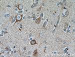 GRID1 Antibody in Immunohistochemistry (Paraffin) (IHC (P))