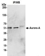 STK15 Antibody in Western Blot (WB)