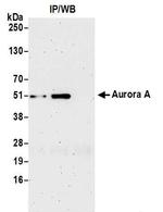 STK15 Antibody in Western Blot (WB)