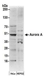 STK15 Antibody in Western Blot (WB)