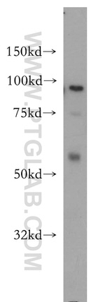 MCM4 Antibody in Western Blot (WB)