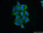 GNS Antibody in Immunocytochemistry (ICC/IF)