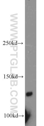 PLEKHA5 Antibody in Western Blot (WB)