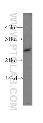 DLX1 Antibody in Western Blot (WB)