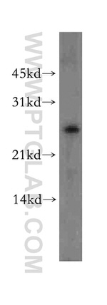 DLX1 Antibody in Western Blot (WB)