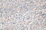 Claudin 1 Antibody in Immunohistochemistry (Paraffin) (IHC (P))