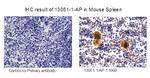 RAB37 Antibody in Immunohistochemistry (IHC)