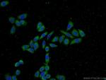 PFDN2 Antibody in Immunocytochemistry (ICC/IF)
