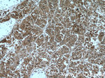 PFDN2 Antibody in Immunohistochemistry (Paraffin) (IHC (P))