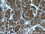 PFDN2 Antibody in Immunohistochemistry (Paraffin) (IHC (P))
