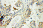 PFDN2 Antibody in Immunohistochemistry (Paraffin) (IHC (P))