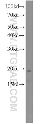 PFDN2 Antibody in Western Blot (WB)