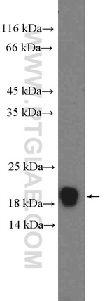 PFDN2 Antibody in Western Blot (WB)
