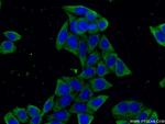 G3BP1 Antibody in Immunocytochemistry (ICC/IF)