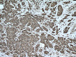G3BP1 Antibody in Immunohistochemistry (Paraffin) (IHC (P))