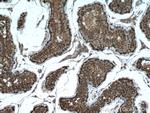 G3BP1 Antibody in Immunohistochemistry (Paraffin) (IHC (P))