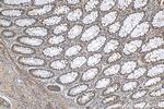 G3BP1 Antibody in Immunohistochemistry (Paraffin) (IHC (P))