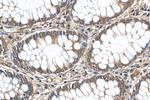 G3BP1 Antibody in Immunohistochemistry (Paraffin) (IHC (P))