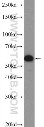 G3BP1 Antibody in Western Blot (WB)