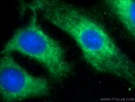 MACF1 Antibody in Immunocytochemistry (ICC/IF)